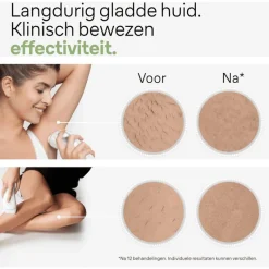 New Braun IPL Silk-expert Pro 3 PL3020