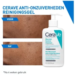 New CeraVe Anti-Onzuiverheden Reiniger 236 ML