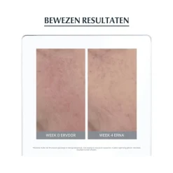 Hot Eucerin AntiREDNESS Corrigerende Crème 50 ML