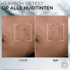 Online L'Oréal Paris L'Oreal Men Expert Derma Control Serum 30ML