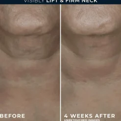 Outlet RoC Derm Correxion Contour Cream 50 ML