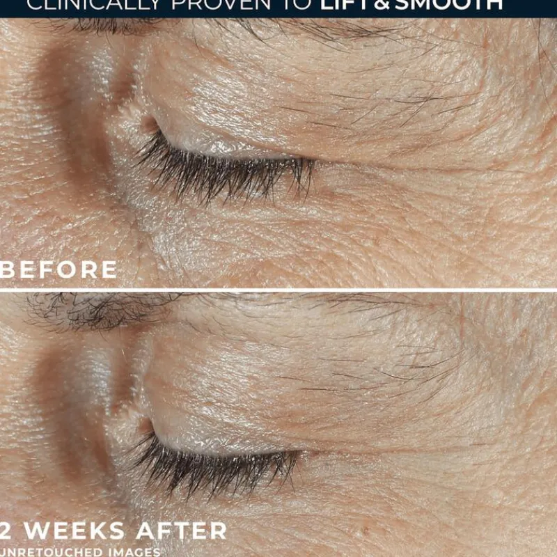 Hot RoC Derm Correxion Dual Eye 20 ML