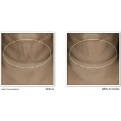 Outlet RoC Derm Correxion Firming Serum Stick