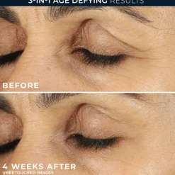 New RoC Retinol Correxion Line Smoothing Eye Cream 15 ML