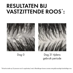 Clearance Vichy Dercos Anti-Roos DS Shampoo NH/VH Navulling 390 ML