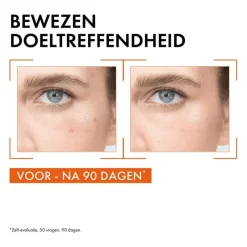 New Vichy Liftactiv Vitamin C Serum 20 ML